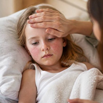 5ème maladie infantile : symptômes, contagion et traitements chez l’enfant
