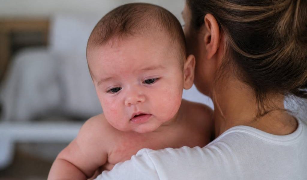 5e maladie symptôme : les signes à surveiller chez bébé